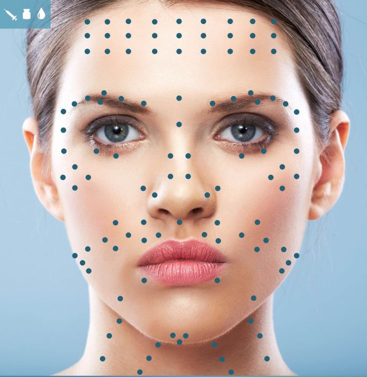 Botox Treatment Points Face Neck | dr Alek Nikolic