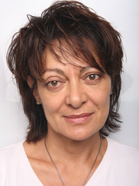 Dermal Fillers after treatment Dermal Fillers after treatment