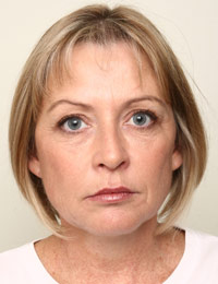 Combination Treatments After