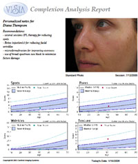 visia report sm